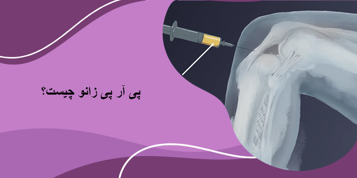 پی آر پی زانو