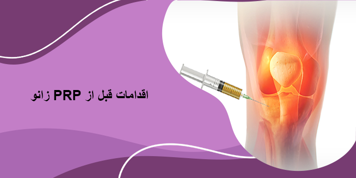 نحوه انجام پی آر پی زانو چگونه است؟