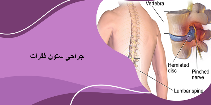 جراحی ستون فقرات