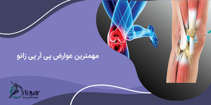 عوارض پی آر پی زانو