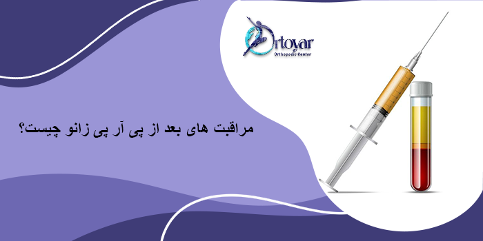 مراقبت های بعد از پی آر پی زانو چیست؟