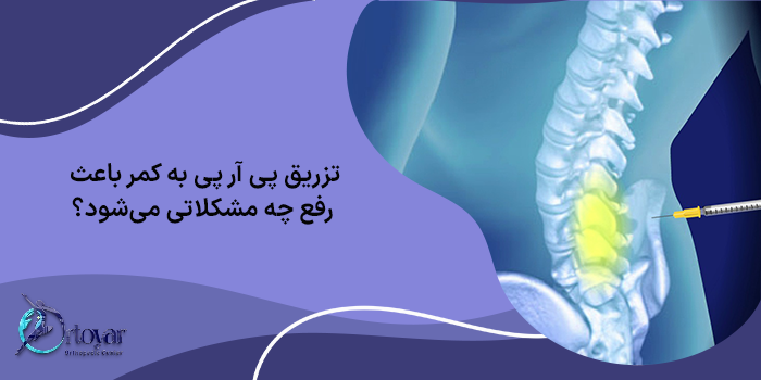 پی آر پی کمر