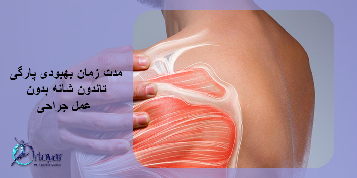 چه کسانی میتوانند پارگی تاندون شانه را بدون جراحی درمان کنند؟
