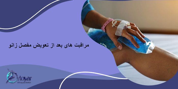 مراقبت های بعد از تعویض مفصل زانو