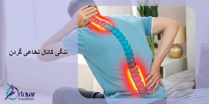 تنگی کانال نخاعی گردن