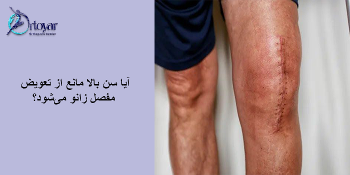 سن مناسب تعویض مفصل زانو