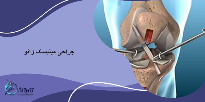 جراحی مینیسک زانو