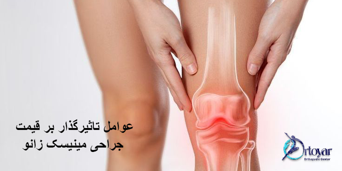 هزینه جراحی مینیسک زانو