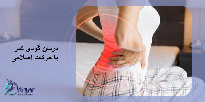 درمان گودی کمر بدون جراحی