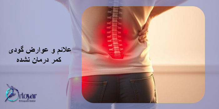 نقش فیزیوتراپی در درمان گودی کمر بدون عمل