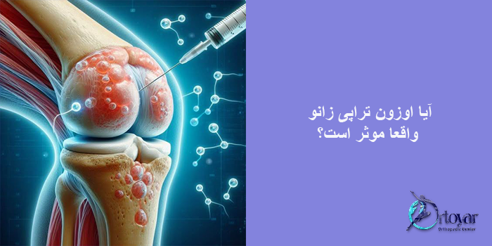 آیا اوزون تراپی زانو واقعا موثر است؟