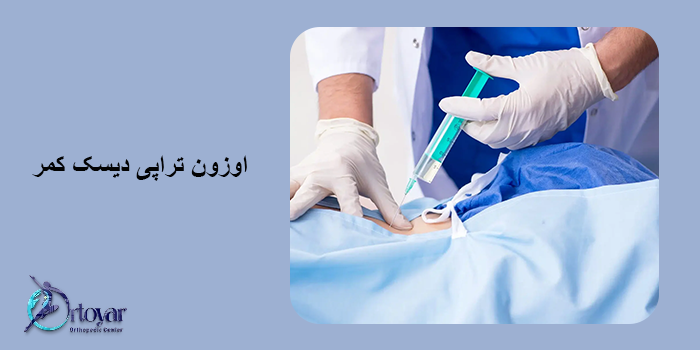 اوزون تراپی دیسک کمر