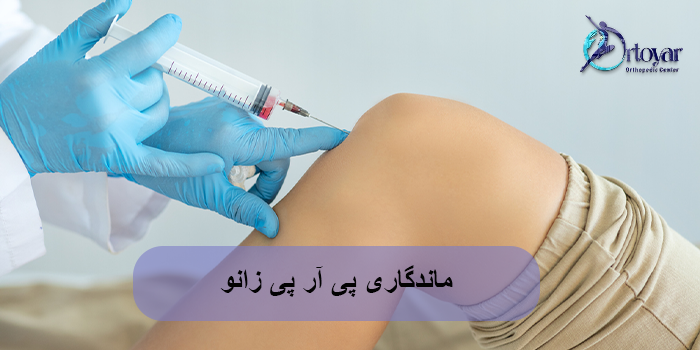 ماندگاری پی آر پی زانو