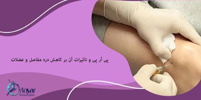 پی آر پی و تاثیرات آن بر کاهش درد مفاصل و عضلات