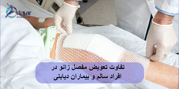 تفاوت تعویض مفصل زانو در افراد سالم و بیماران دیابتی